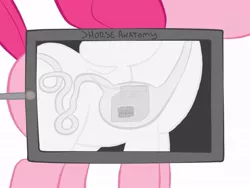 Size: 1024x768 | Tagged: cake, derpibooru import, oven, pinkie pie, safe, stomach, x-ray, x-ray picture
