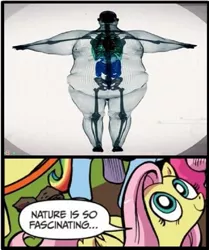 Size: 591x706 | Tagged: derpibooru import, exploitable meme, fat, fluttershy, human, meme, morbidly obese, nature is so fascinating, obese, obligatory pony, safe, skeleton, x-ray, x-ray picture