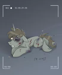 Size: 760x912 | Tagged: grimdark, artist:mymineawesome, derpibooru import, oc, unofficial characters only, pony, unicorn, abuse, black eye, bleeding, blood, bruised, camera, camera shot, cut, prone, signature, solo