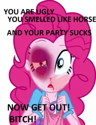 Size: 791x1024 | Tagged: semi-grimdark, derpibooru import, edit, pinkie pie, equestria girls, abuse, abuse edit, background pony strikes again, black eye, blood, crying, domestic abuse, downvote bait, edgy, eqg abuse edits, female, nosebleed, pinkiebuse, we are going to hell