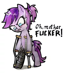 Size: 732x828 | Tagged: artist:mcponyponypony, crutches, derpibooru import, injured, oc, oc:emcee, safe, solo, unofficial characters only, vulgar