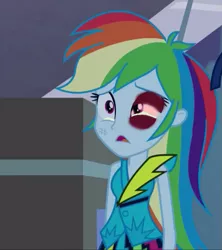 Size: 633x714 | Tagged: semi-grimdark, derpibooru import, edit, edited screencap, screencap, rainbow dash, equestria girls, rainbow rocks, abuse, abuse edit, black eye, dashabuse, edgy, eqg abuse edits, female, sad