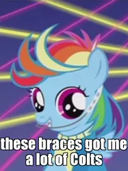 Size: 628x838 | Tagged: safe, derpibooru import, edit, edited screencap, screencap, rainbow dash, pony, parental glideance, adorkable, braces, cropped, cute, dork, female, filly, filly rainbow dash, headgear, image macro, meme, solo, younger