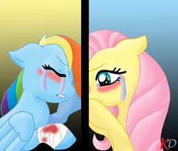 Size: 1174x1000 | Tagged: semi-grimdark, artist:khaotixdreamfd, derpibooru import, fluttershy, rainbow dash, bandage, blood, crying, female, flutterdash, injured, lesbian, shipping