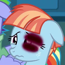 Size: 645x645 | Tagged: 1000 years in photoshop, abuse, abuse edit, background pony strikes again, black eye, bow hothoof, cropped, crying, derpibooru import, downvote bait, edit, edited screencap, female, parental glideance, quality, sad, screencap, semi-grimdark, solo focus, windybuse, windy whistles