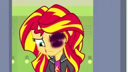 Size: 1280x720 | Tagged: grimdark, derpibooru import, edit, edited screencap, screencap, sunset shimmer, equestria girls, 1000 hours in ms paint, abuse, abuse edit, background pony strikes again, black eye, blood, downvote bait, eqg abuse edits, nosebleed, op isn't even trying anymore, shimmerbuse