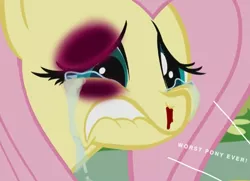 Size: 508x367 | Tagged: semi-grimdark, derpibooru import, edit, edited screencap, screencap, fluttershy, pegasus, pony, a bird in the hoof, 1000 hours in ms paint, abuse, abuse edit, background pony strikes again, bad edit, black eye, blood, bruised, cropped, crying, delete this please, downvote bait, drama bait, female, flutterbuse, mare, nosebleed, solo, text, wat, why, wings