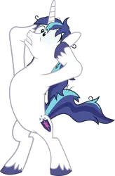 Size: 1984x3023 | Tagged: safe, artist:outlawquadrant, derpibooru import, screencap, shining armor, pony, unicorn, the crystalling, bipedal, cracked armor, crazy face, faic, hooves on face, messy hair, on hind legs, simple background, solo, transparent background