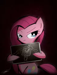 Size: 1440x1913 | Tagged: safe, artist:therandomjoyrider, derpibooru import, pinkie pie, earth pony, pony, bipedal, bone, female, heart, heart (organ), mare, organs, pinkamena diane pie, skeleton, solo, x-ray