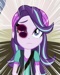 Size: 534x669 | Tagged: semi-grimdark, banned from derpibooru, deleted from derpibooru, derpibooru import, edit, edited screencap, screencap, starlight glimmer, equestria girls, mirror magic, spoiler:eqg specials, abuse, abuse edit, black eye, crying, downvote bait, eqg abuse edits, glimmerbuse, sad