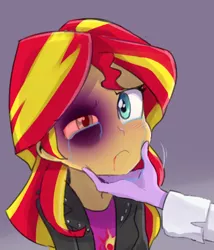 Size: 484x566 | Tagged: grimdark, banned from derpibooru, deleted from derpibooru, derpibooru import, edit, sci-twi, sunset shimmer, twilight sparkle, equestria girls, rainbow rocks, abuse, abuse edit, art theft, black eye, blood, bruised, crying, domestic abuse, downvote bait, frown, shimmerbuse