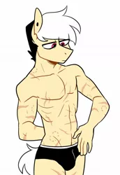 Size: 884x1288 | Tagged: semi-grimdark, suggestive, artist:redxbacon, derpibooru import, oc, oc:note clip, anthro, earth pony, abs, adonis belt, anthro oc, biceps, bite mark, black underwear, clothes, crotch bulge, frown, image, jpeg, male, muscles, partial nudity, pecs, rule 63, scar, sexy, solo, solo male, topless, two toned mane, underwear