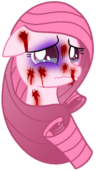 Size: 399x696 | Tagged: artist needed, source needed, semi-grimdark, derpibooru import, edit, oc, oc:annisa trihapsari, unofficial characters only, earth pony, pony, abuse, abuse edit, black eye, blood, crying, female, floppy ears, image, implied my little pony 'n friends, mare, nosebleed, png, poor, sad, simple background, solo, transparent background