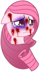Size: 399x696 | Tagged: artist needed, source needed, semi-grimdark, derpibooru import, edit, oc, oc:annisa trihapsari, unofficial characters only, earth pony, pony, abuse, abuse edit, black eye, blood, crying, female, floppy ears, image, implied my little pony 'n friends, mare, nosebleed, png, poor, sad, simple background, solo, transparent background