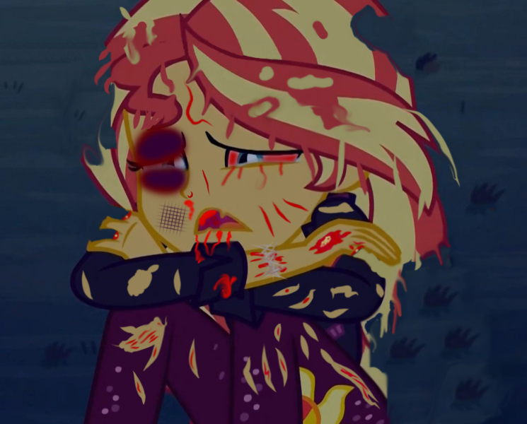 Size: 1137x916 | Tagged: grimdark, derpibooru import, edit, sunset shimmer, 1000 hours in fire alpaca, abuse, abuse edit, black eye, blood, bone, clothes, image, pants, png, ripped pants, shimmerbuse, tattered clothes, torn clothes
