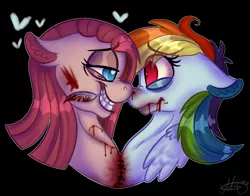 Size: 1136x892 | Tagged: grimdark, artist:millefaller, derpibooru import, pinkie pie, rainbow dash, earth pony, pegasus, pony, bedroom eyes, black background, blood, conjoined, duo, eyelashes, female, heart, image, lesbian, mare, mouth hold, pinkamena diane pie, pinkiedash, png, scar, scared, shipping, signature, simple background, stitches